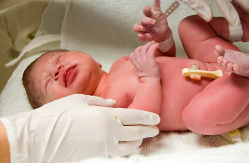 newborn baby with cut umbilical cord