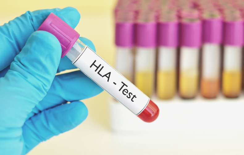 FAQ: Why HLA Matching is Important Before a Cord Blood Transplant?