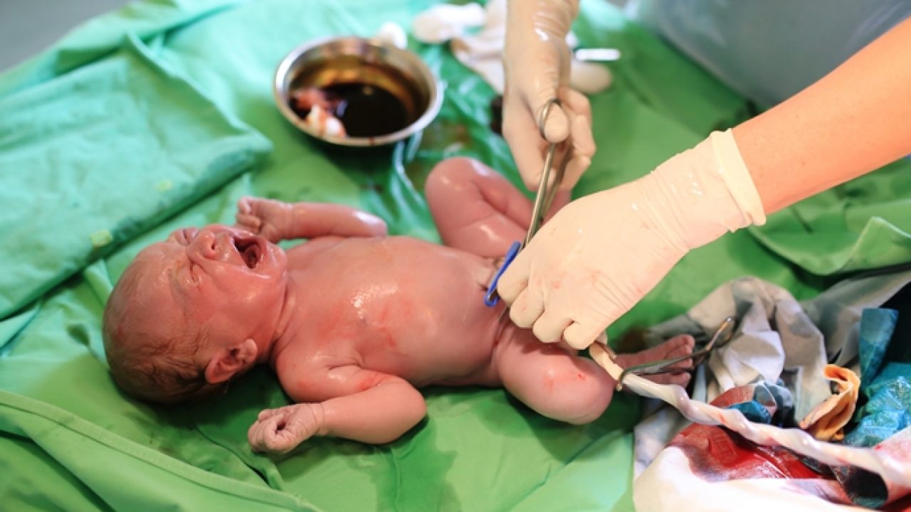 Should You Save Your Baby's Umbilical Cord Tissue?