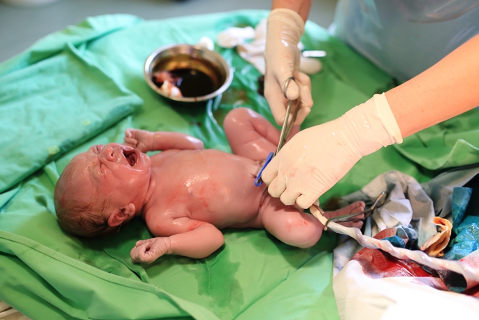 Should You Save Your Baby’s Umbilical Cord Tissue?