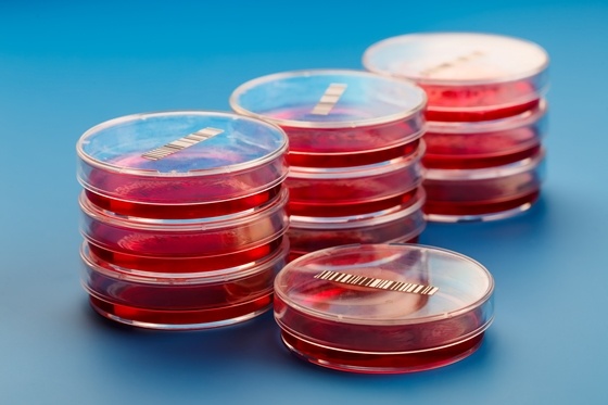 Identifying New Approach to Make More Stem Cells from Cord Blood