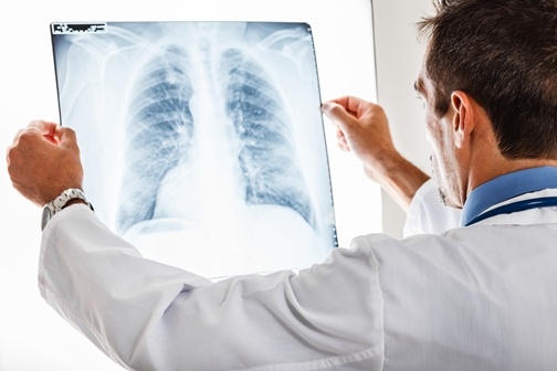 Stem Cell Therapy Shows Promise in a Clinical Trial for Lung Disease