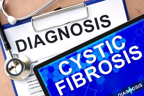Mesenchymal Stem Cell Therapy Reduces Inflammation in Cystic Fibrosis