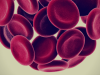 Donated Umbilical Cord Blood Helped Save a Life