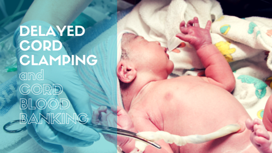 Delayed Cord Clamping and Successful Cord Blood Banking