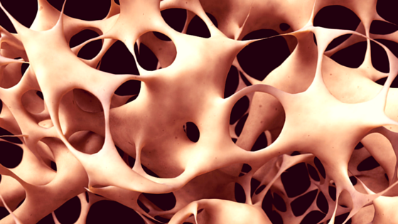 Experimental Stem Cell Treatment Reverses Osteoporosis