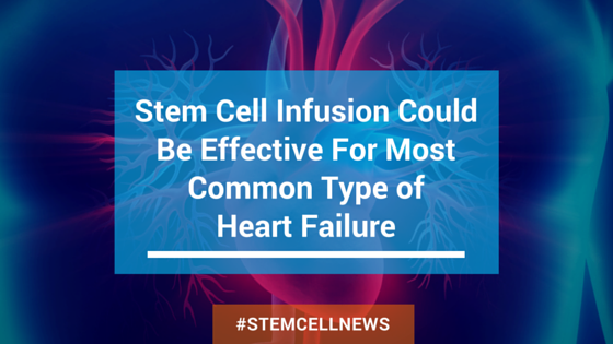 Stem Cell Infusion Could Be Effective for Heart Failure