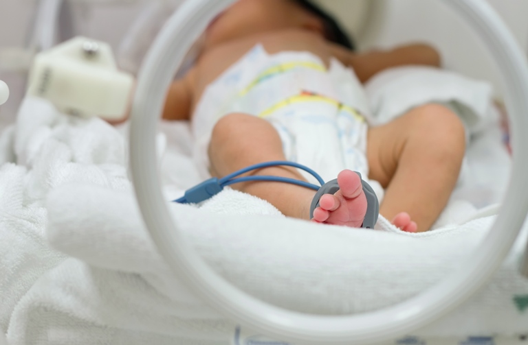 Placental Stem Cells for Premature Babies with Chronic Lung Disease