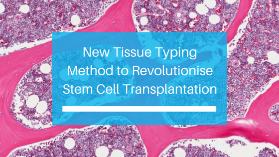 New Tissue Typing Method to Revolutionise Stem Cell Transplantation