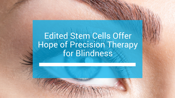 Edited Stem Cells Offer Hope of Precision Therapy for Blindness