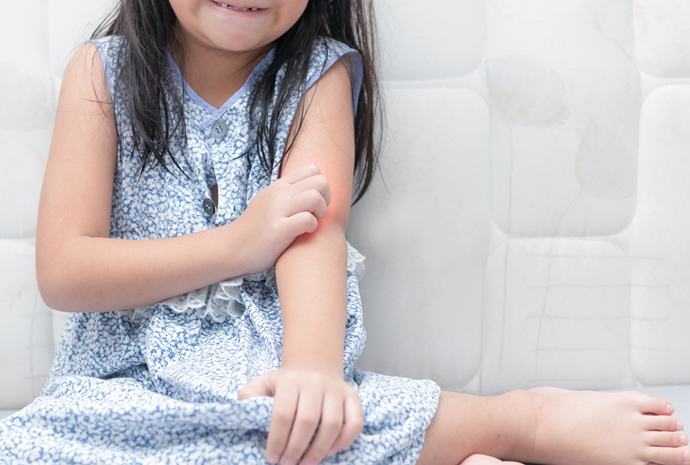 5 Common Summer Toddler Skin Problems & How to Deal with Them