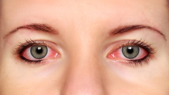 June is Cataract Awareness Month!