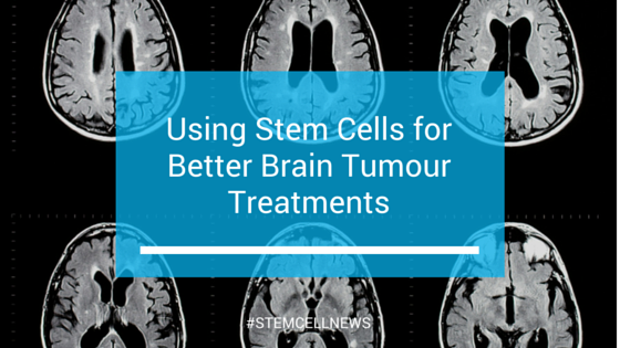 Using Stem Cells for Better Brain Tumour Treatments
