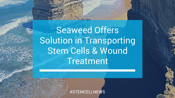Seaweed Offers Solution in Transporting Stem Cells and Wound Treatment