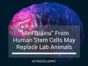 ‘Mini Brains’ From Human Stem Cells May Replace Lab Animals