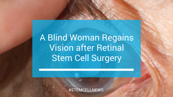A Blind Woman Regains Vision after Retinal Stem Cell Surgery