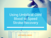 Using Umbilical Cord Blood to Speed Up Stroke Recovery