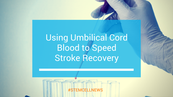 Using Umbilical Cord Blood to Speed Up Stroke Recovery