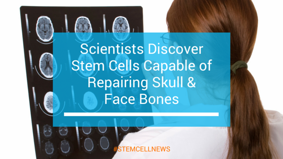 Scientists Discover Stem Cells Capable of Repairing Skull & Face Bones