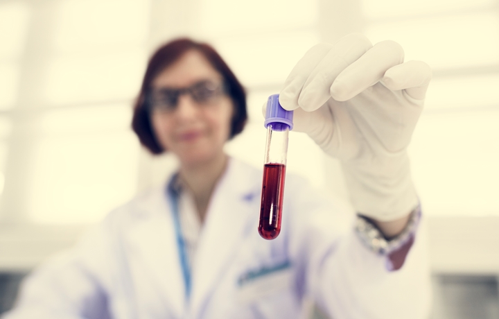 Cord Blood as a Biomarker to Identify Infants at Risk of Cerebral Palsy
