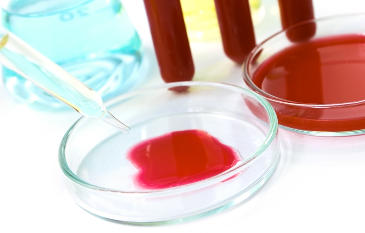 Using Cord Blood Stem Cells to Treat Cystic Fibrosis