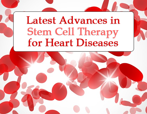 Latest Advances in Stem Cell Therapy for Heart Disease