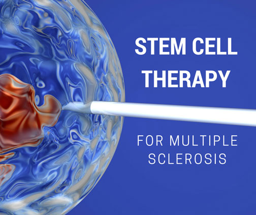 Stem Cell Therapy for Multiple Sclerosis