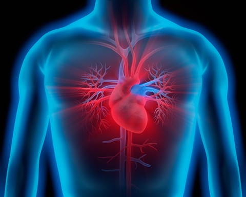 Stem Cell Therapy for Heart Attack (Myocardial Infarction)