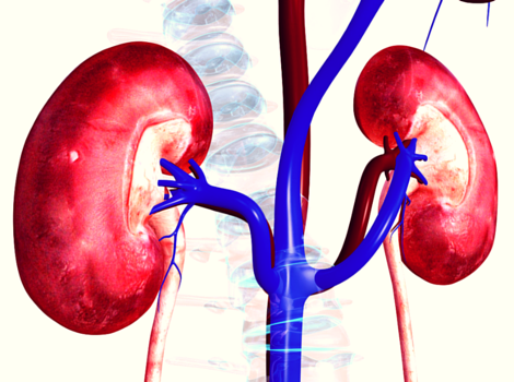 New Groundbreaking Stem Cell Treatment for Diabetic Kidney Disease