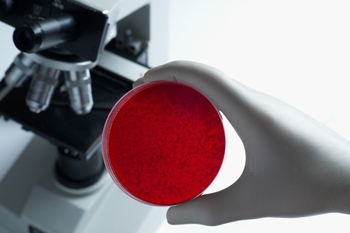 Treatment for Haemophilia Patients Using Stem Cells