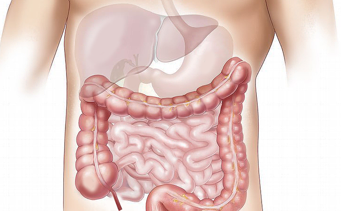 The Intestine has a Reservoir of Stem Cells Resistant to Chemotherapy