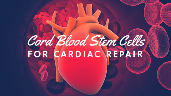 The Role of Umbilical Cord Blood Stem Cells for Cardiac Repair
