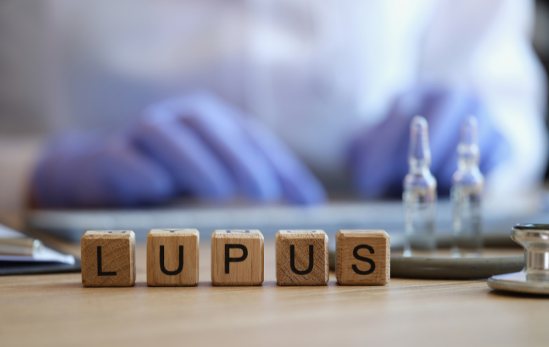The Potential of Umbilical Cord-Derived MSCs for Lupus Treatment