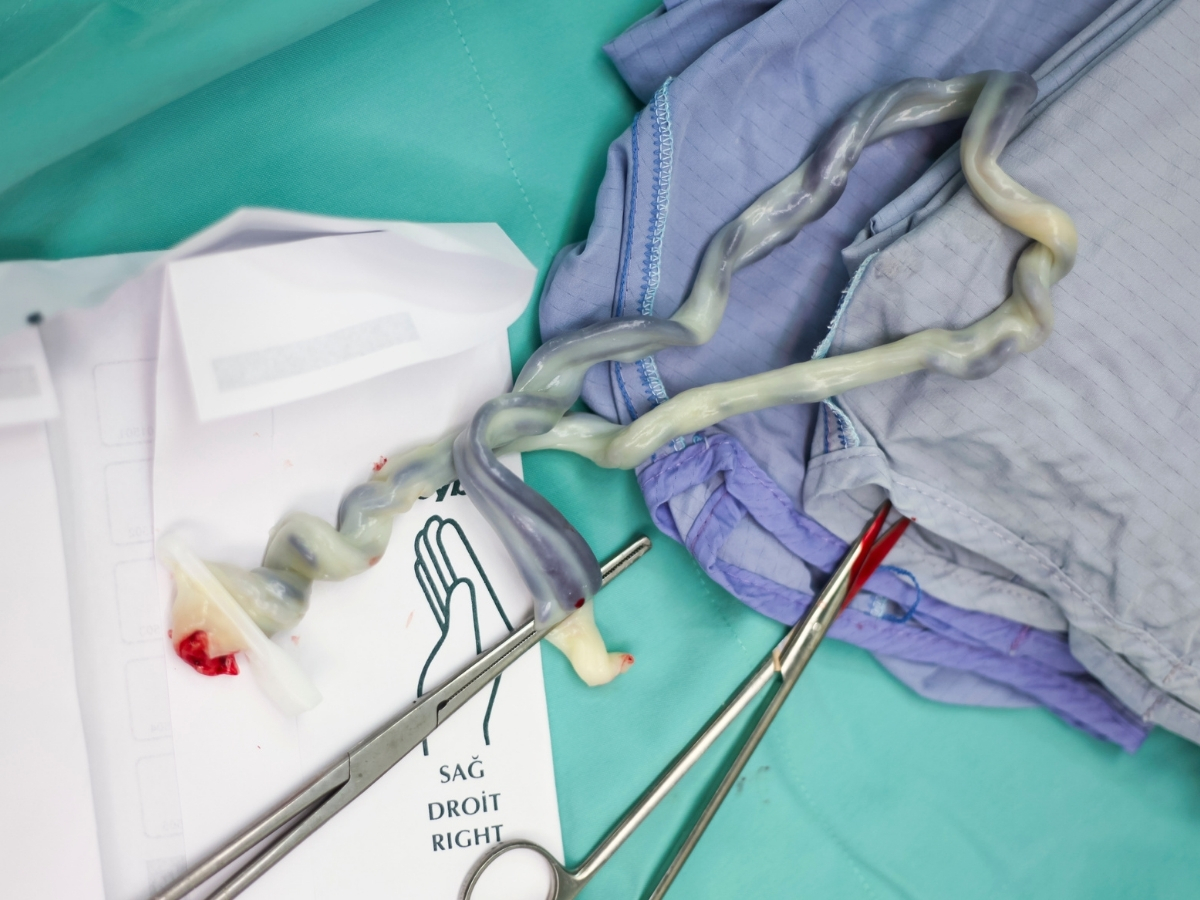 Delayed Cord Clamping Delayed Cord Clamping at Birth